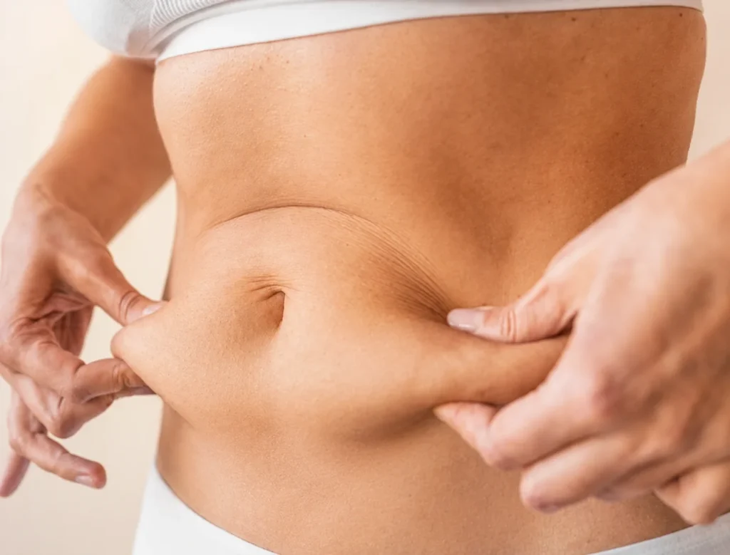 Lipolaser con Endolaser